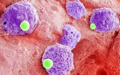 Two-cells-in-one combo could be platform to bolster leukemia treatment