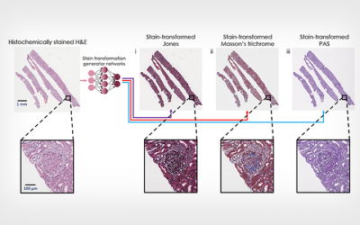 Artificial Intelligence Re-stained Images of Tissue Biopsy Expedite Diagnoses